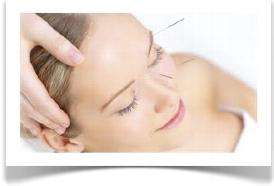 Cosmetic Acupuncture. Facial